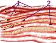 малюнок мікроскопічної будови посмугованої м’язової тканини