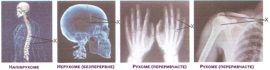 Підпишіть фото відділу опорно-рухового апарату