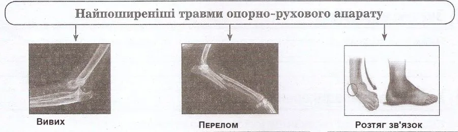 схема травм