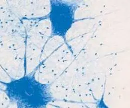 Дослідження мікроскопічної будови нейрона та нервової тканини