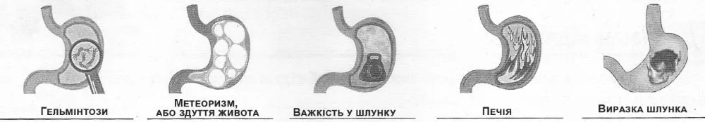 озгляньте піктограми та підпишіть, які недоліки роботи шлунка вони відображають