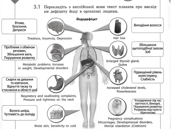 Перекладіть з англійської мови текст плаката про наслідки дефіциту йоду в організмі людин