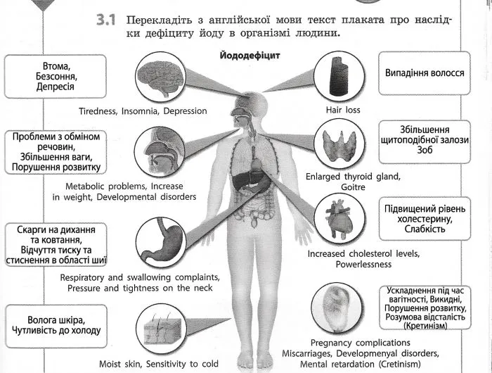Перекладіть з англійської мови текст плаката про наслідки дефіциту йоду в організмі людин