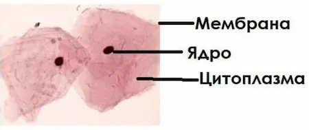 Малюнок клітин епітелію щоки