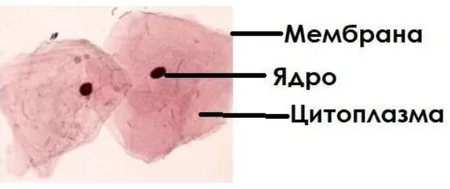 Малюнок клітин епітелію щоки