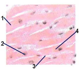 Посмугована серцева